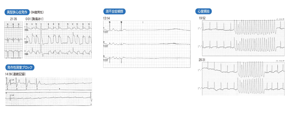 ホルター心電図の記録の画像